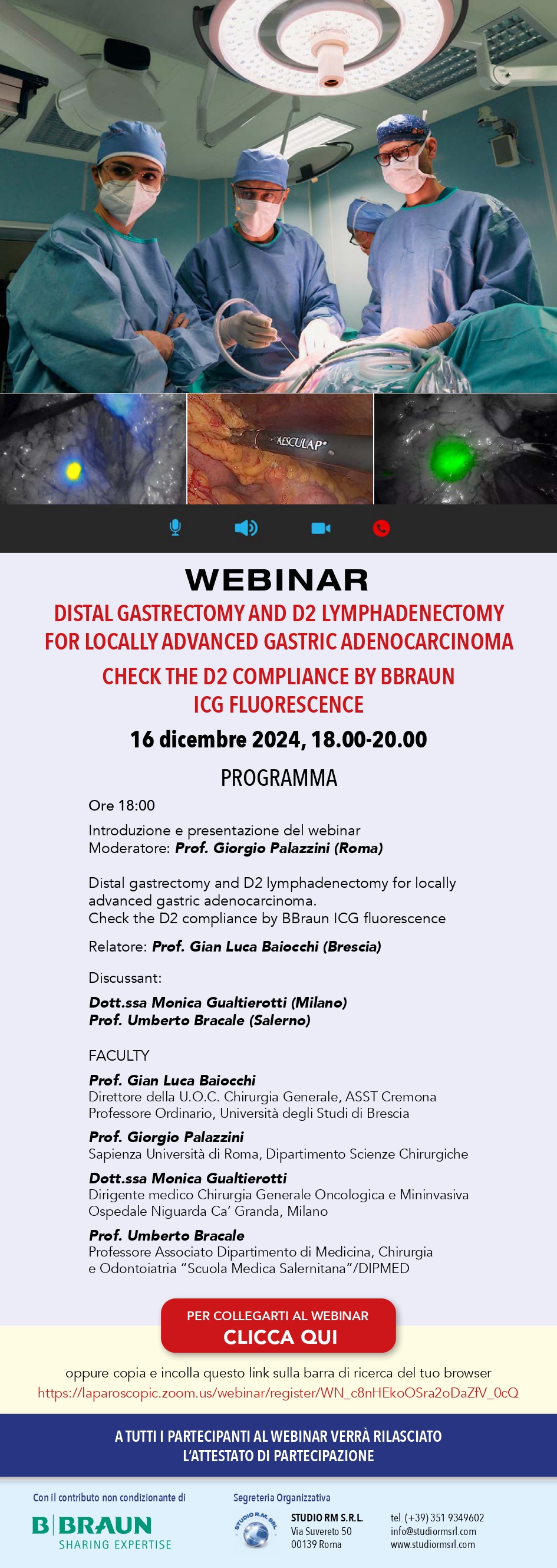 Distal gastrectomy and D2 lymphadenectmy for locally advanced gastric adenocarcinoma. Ceck the D2 compliance by B.Braun ICG fluorescence