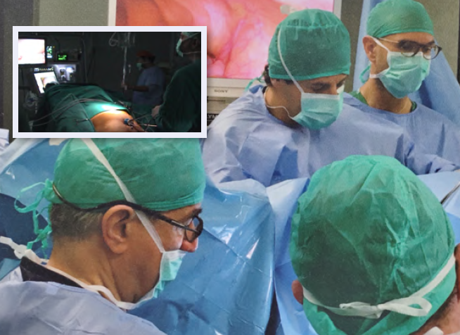 Trattamento laparoscopico delle ernie diaframmatiche