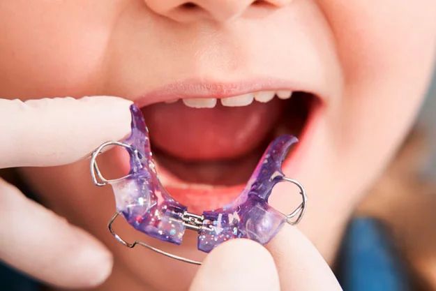 Ortopedia Dentofacial