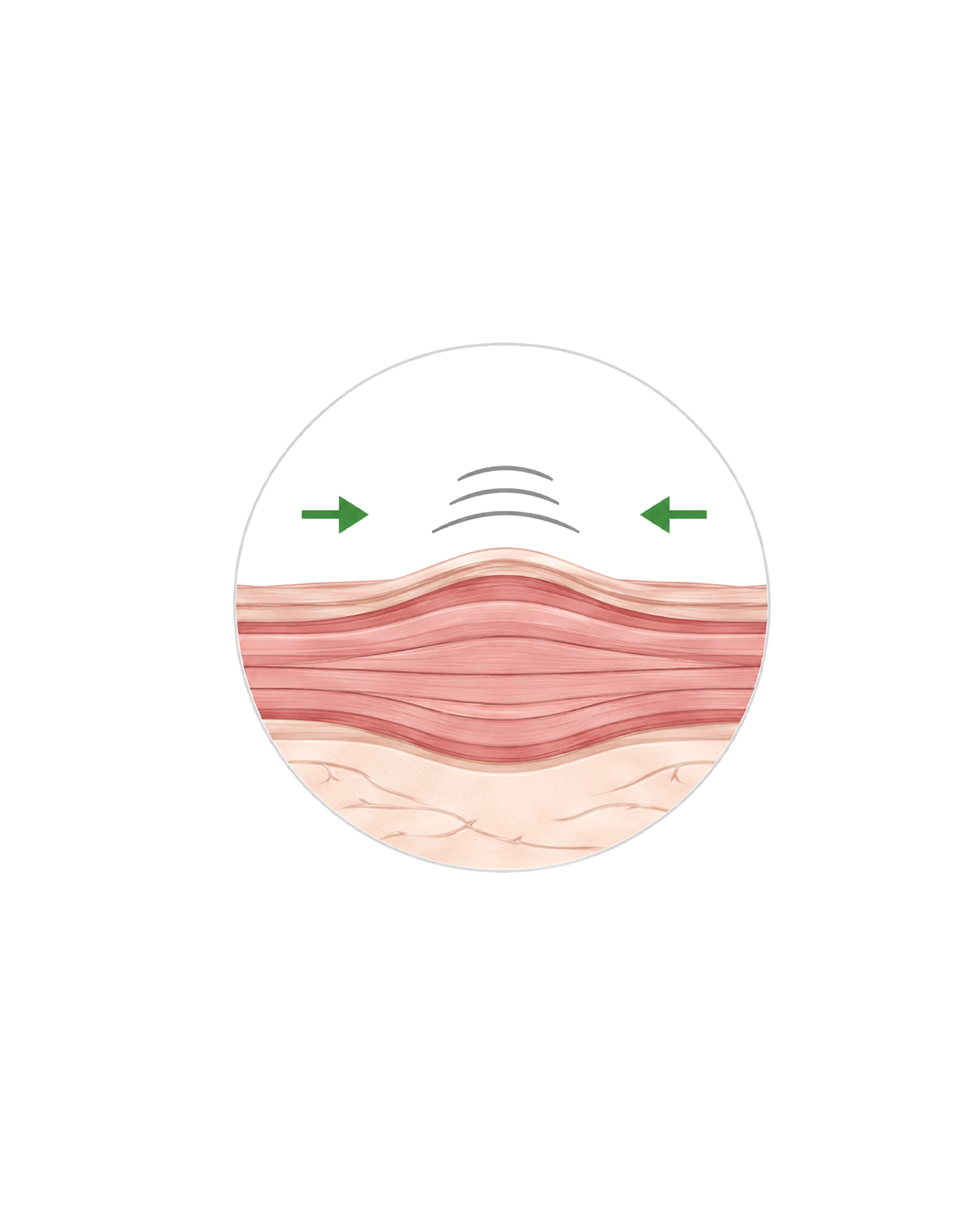 EXPRESSION MUSCLE
