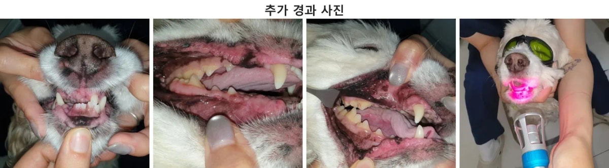 수술 후 붓기가 가라앉고 활력을 되찾은 최키키의 모습