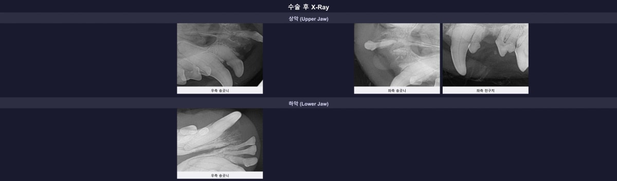 모든 발치와 보존 치료가 깔끔하게 마무리된 수술 후 방사선 사진