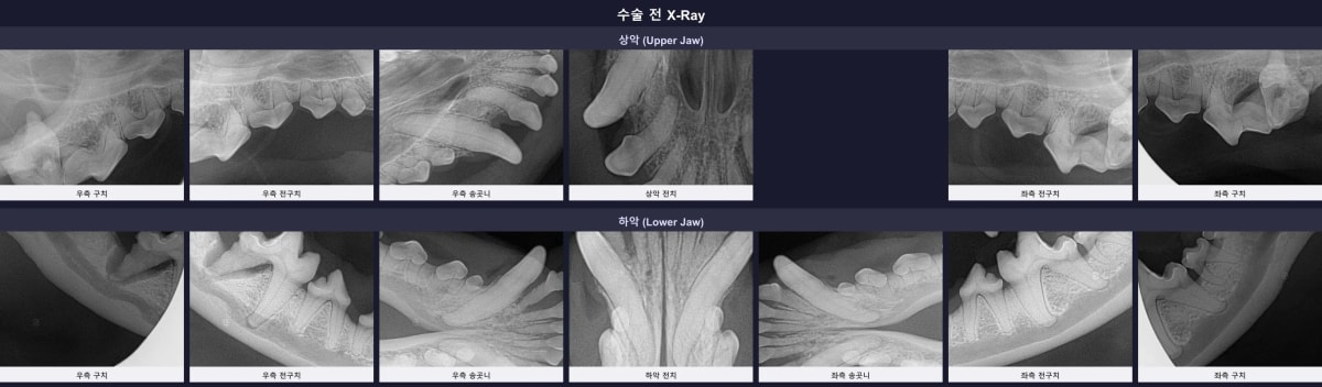 수술 전 전체 구강 X-Ray 소견