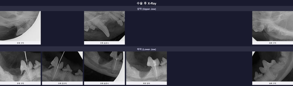 수술 후 X-Ray를 통한 치과 수술 결과 확인