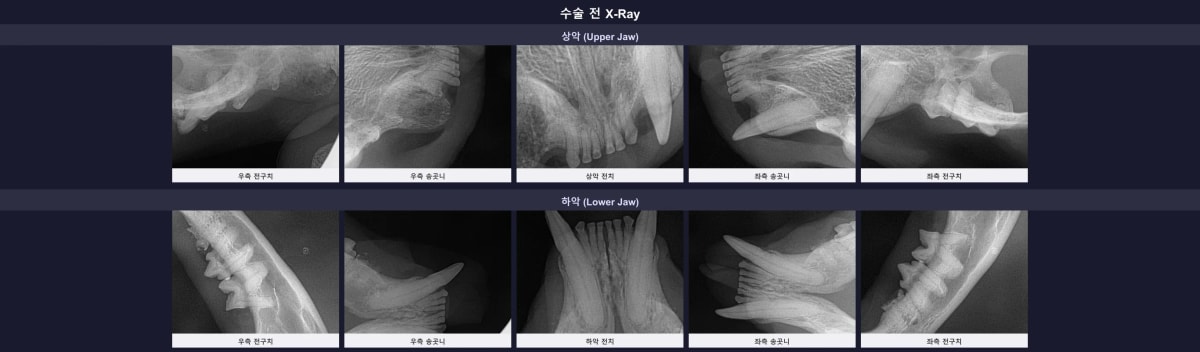 수술 전 촬영된 롯테의 전체 구강 엑스레이 소견