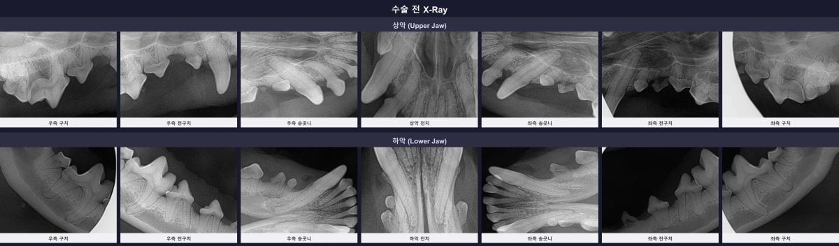 수술 전 전체 구강 방사선 엑스레이 소견