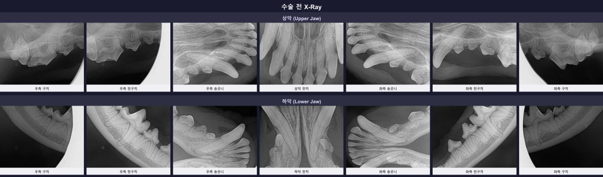 수술 전 전체 구강 X-Ray
