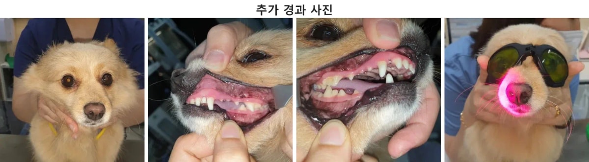 치료 후 잇몸이 잘 회복된 경과 사진