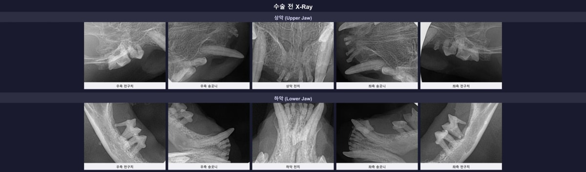 수술 전 전체 구강 방사선