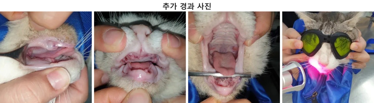 치료 후 회복된 구강 상태
