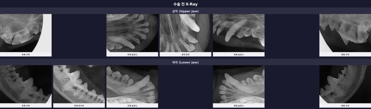 수술 전 전체 구강 엑스레이 진단 결과