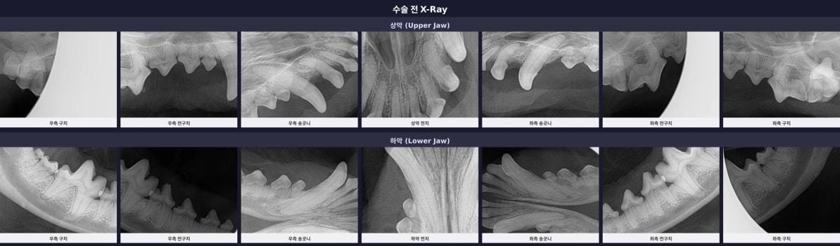 수술 전 전체 구강 방사선(X-ray) 촬영 영상