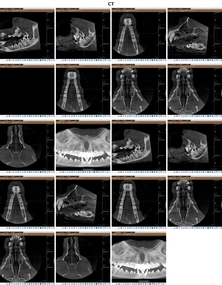 치아 뿌리와 턱뼈 상태를 입체적으로 분석하는 치과 전용 CT 스캔