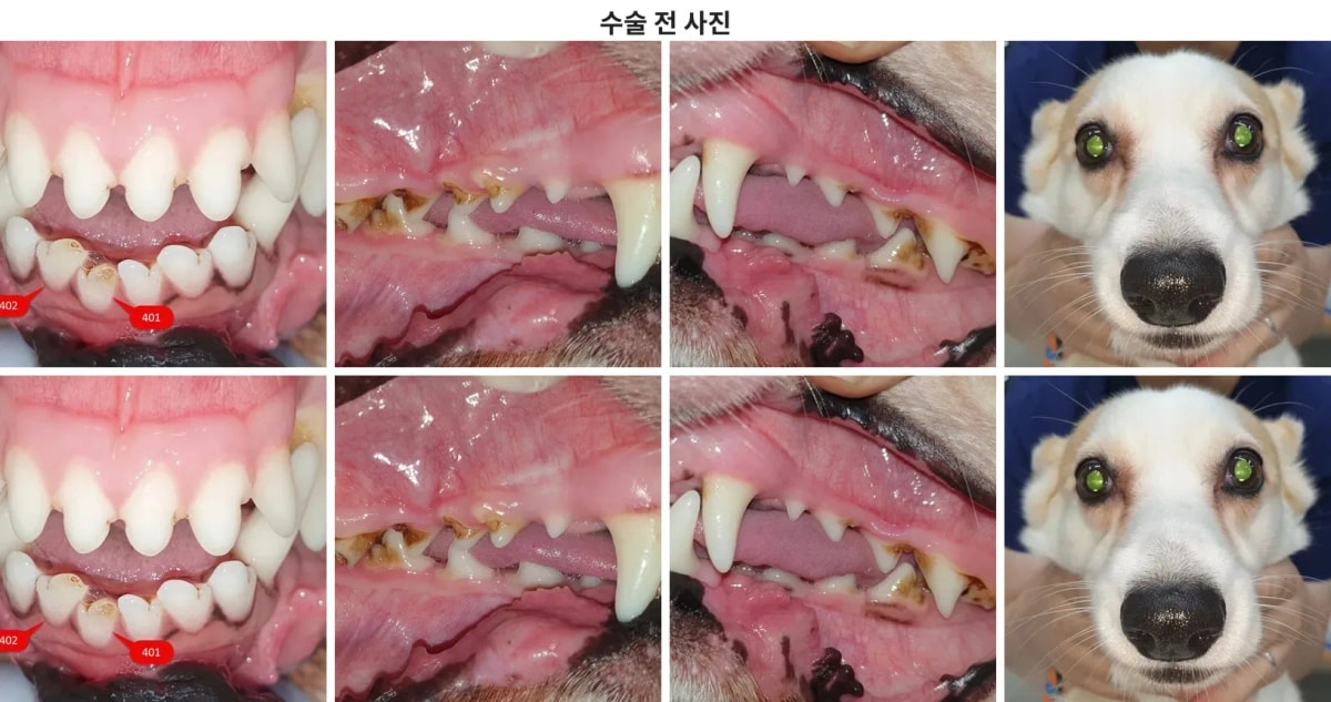 수술 전 사진 (환자 얼굴 및 구강 상태)