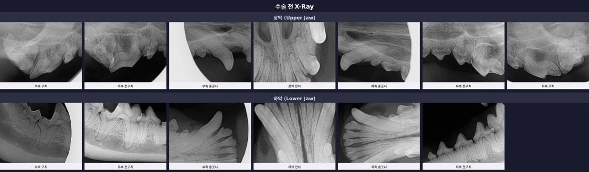 수술 전 치과 X-Ray