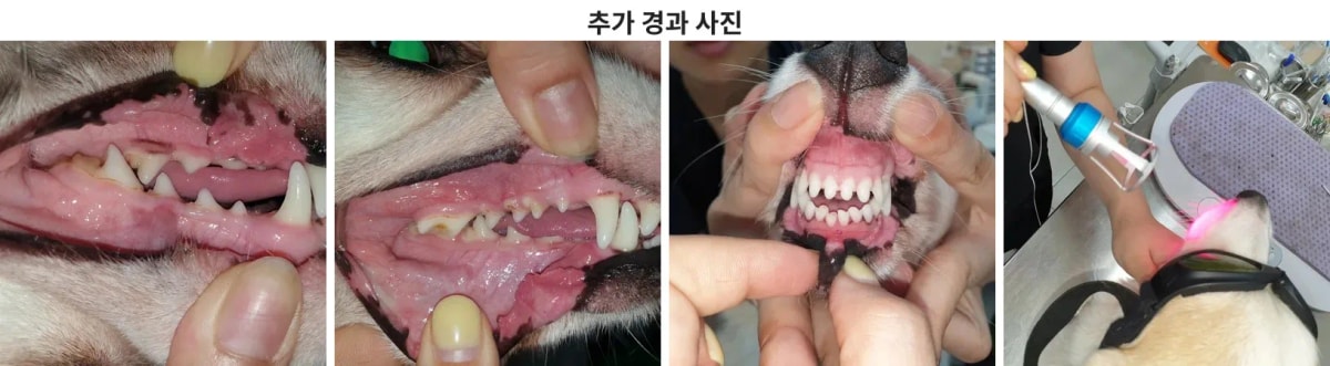 치료 후 관리 안내