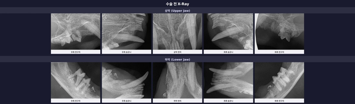 수술 전 상악·하악 전체 구강 엑스레이