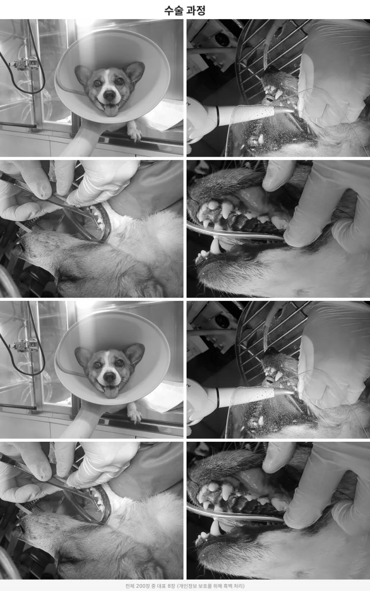 surgery 검사 및 치료 자료