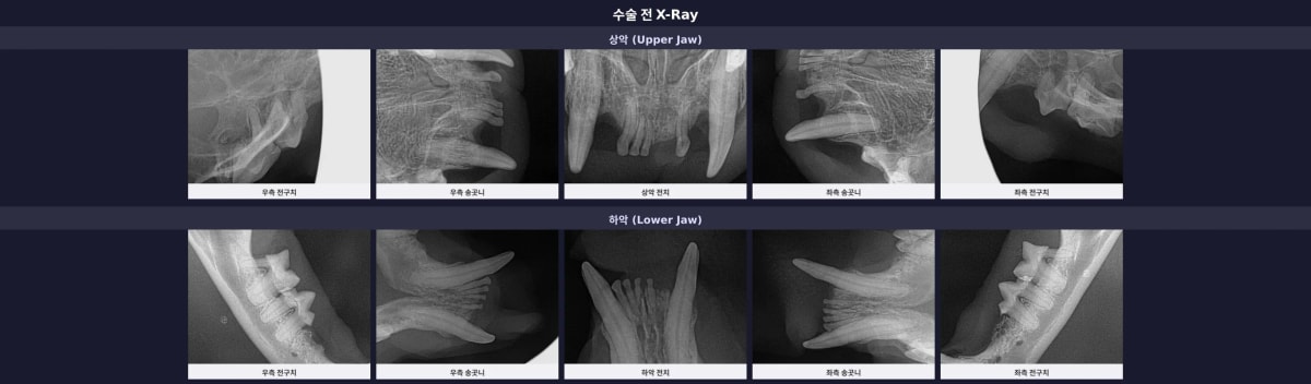 수술 전 구강 전체 X-Ray