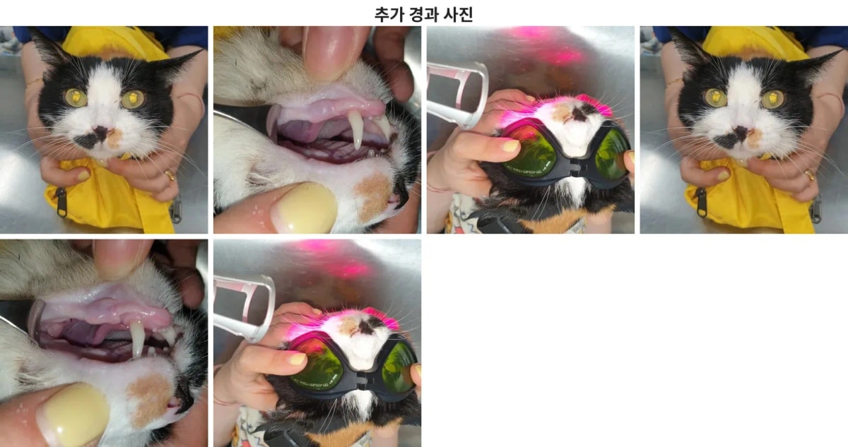 수술 후 관리 및 개선된 상태