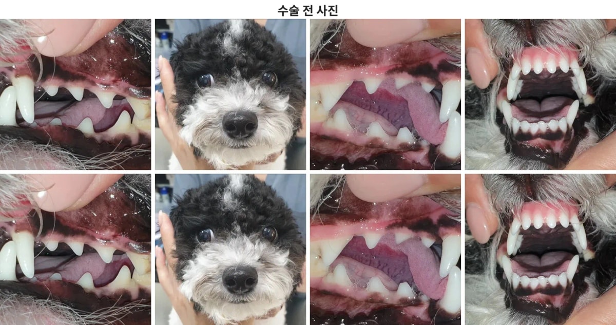 수술 전 사진 (환자 얼굴 및 구강 상태)