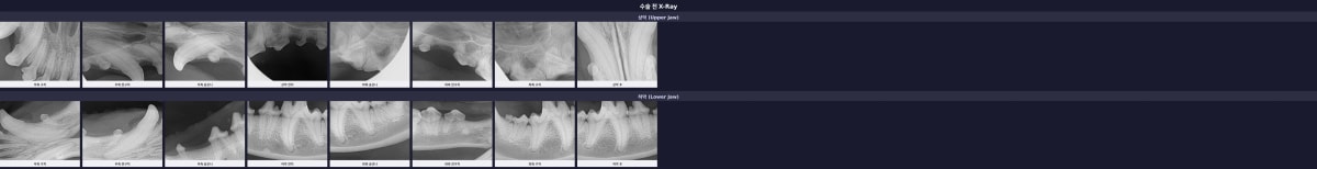 수술 전 구강 상태를 확인하는 정밀 X-ray 결과