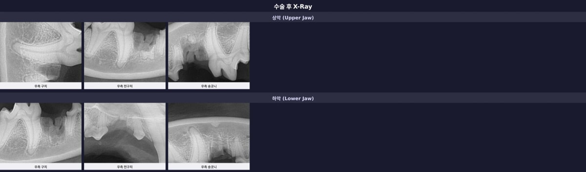 수술 후 깨끗하게 정리된 구강 상태의 X-ray 결과