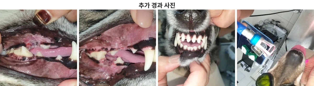 치아 보존 및 잇몸 염증 관리 처치 내용