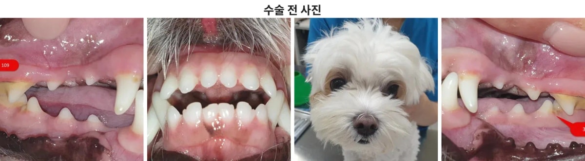 수술 전 사진 (환자 얼굴 및 구강 상태)