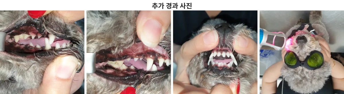 임상 사진