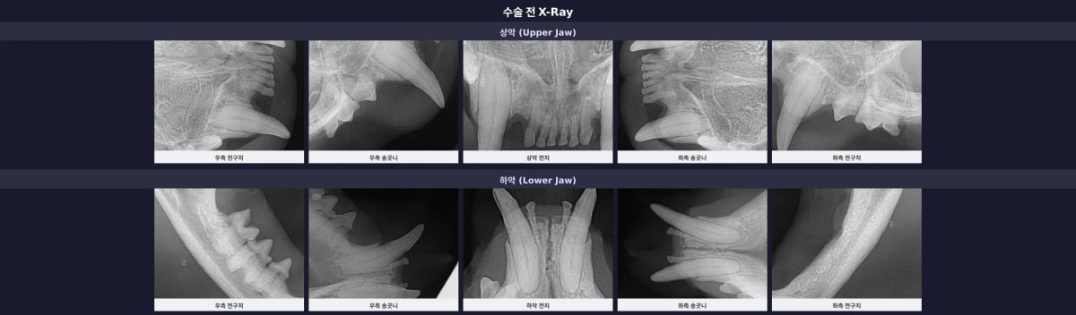 치료 전 치과 X-ray