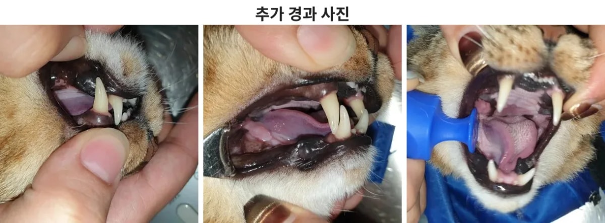 수술 2개월 후 깨끗하게 유지된 구강 상태
