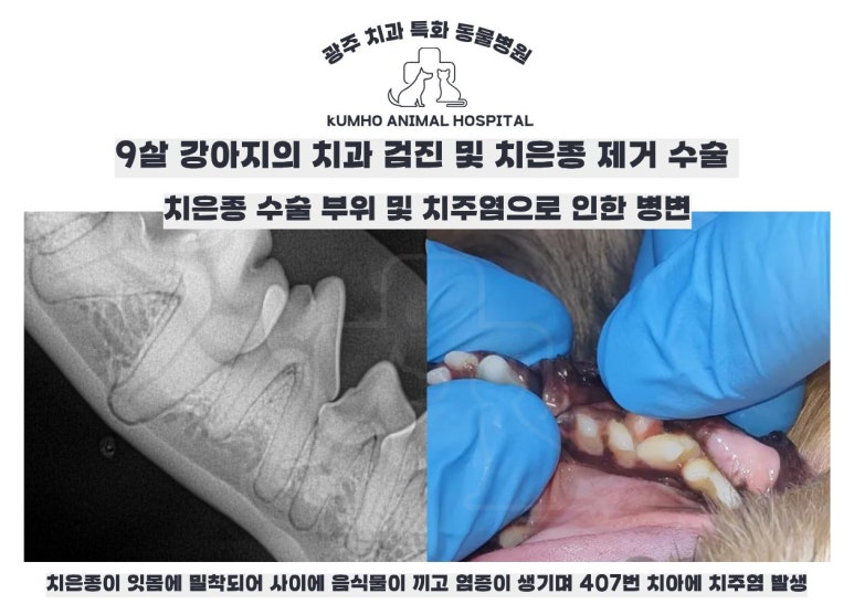 구강 종양