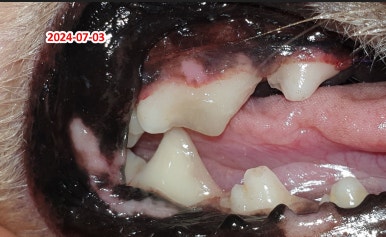 신경치료