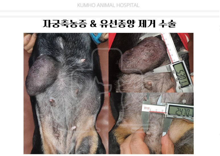 유선 종양 제거 수술