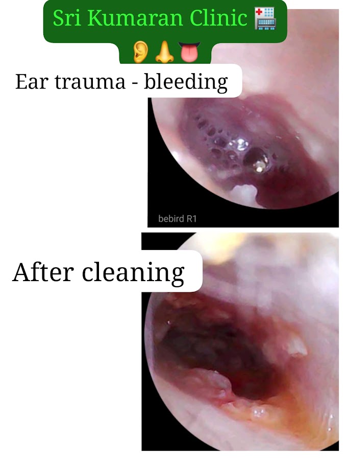 SRI KUMARAN CLINIC, Dr Bhuvaneshwari( ENT specialist) photo 2