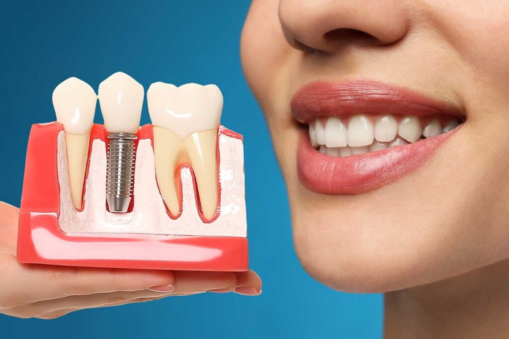 Diş implantı yatırımınızı ömür boyu koruyun. Günlük hijyen, profesyonel kontroller ve kaçınılması gereken alışkanlıklar dahil temel bakım ipuçlarını öğrenin.
