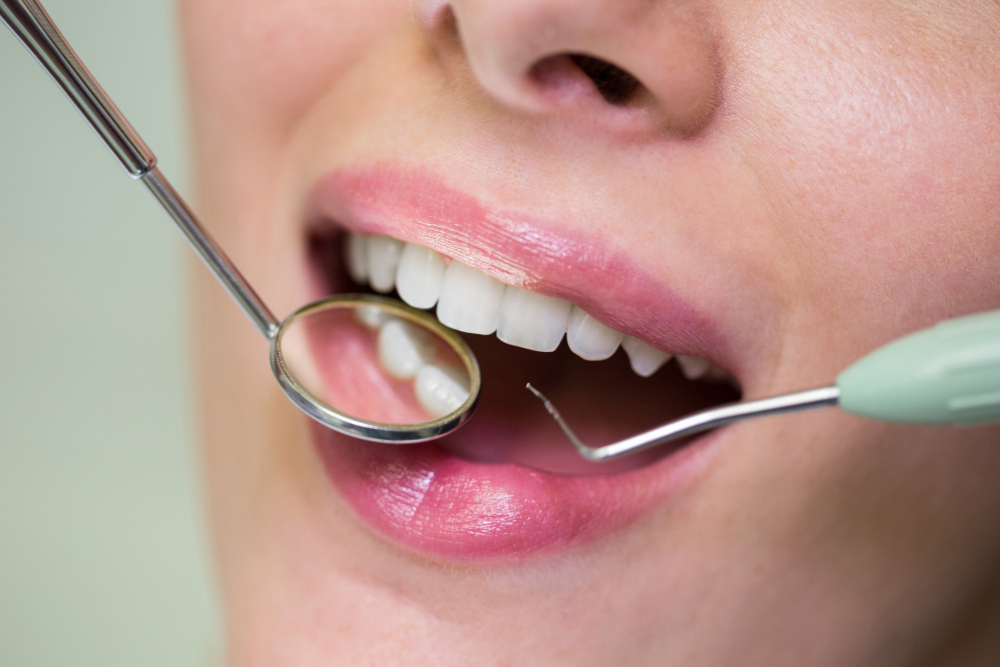 A perfect, bright white smile after aesthetic dentistry.
