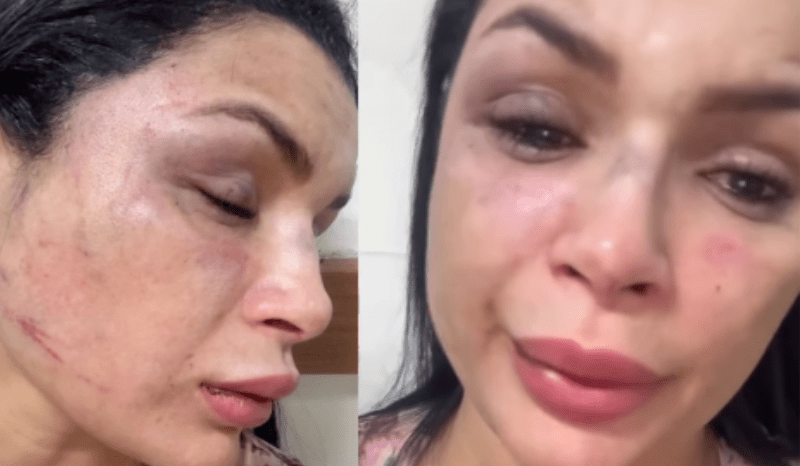 Musa da Aparecida presta depoimento e diz não reconhecer motorista acusado de agressão em Manaus