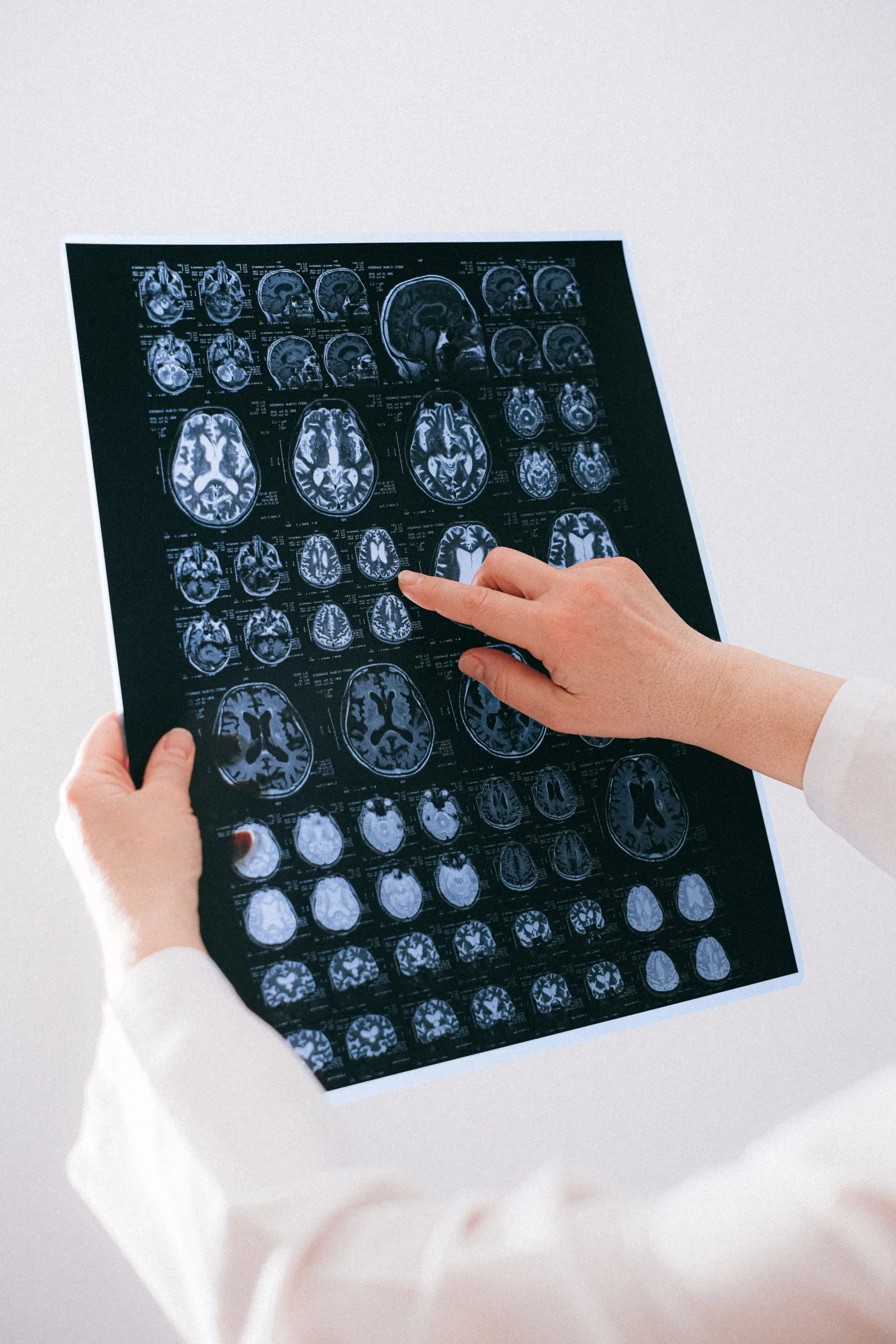 Why a Secondary Brain Is Your Ultimate Shield for Mental Longevity