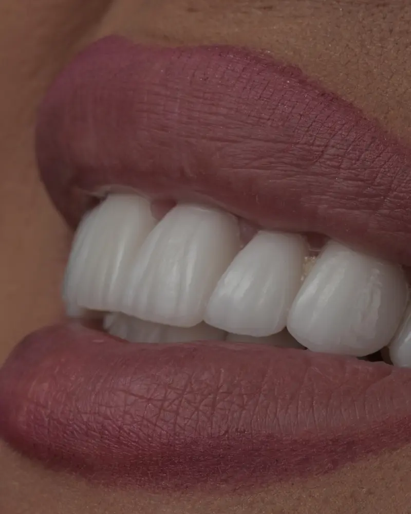 Procedură minim invazivă