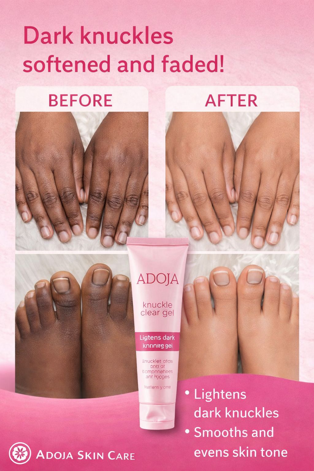 Adoja black treatment soap