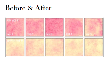 MEDIPAIR Deep Moisture Fluid (Skin Barrier Cream) photo 3