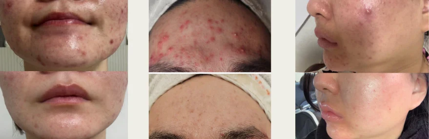 MEDIPAIR Plasma Cream photo 3