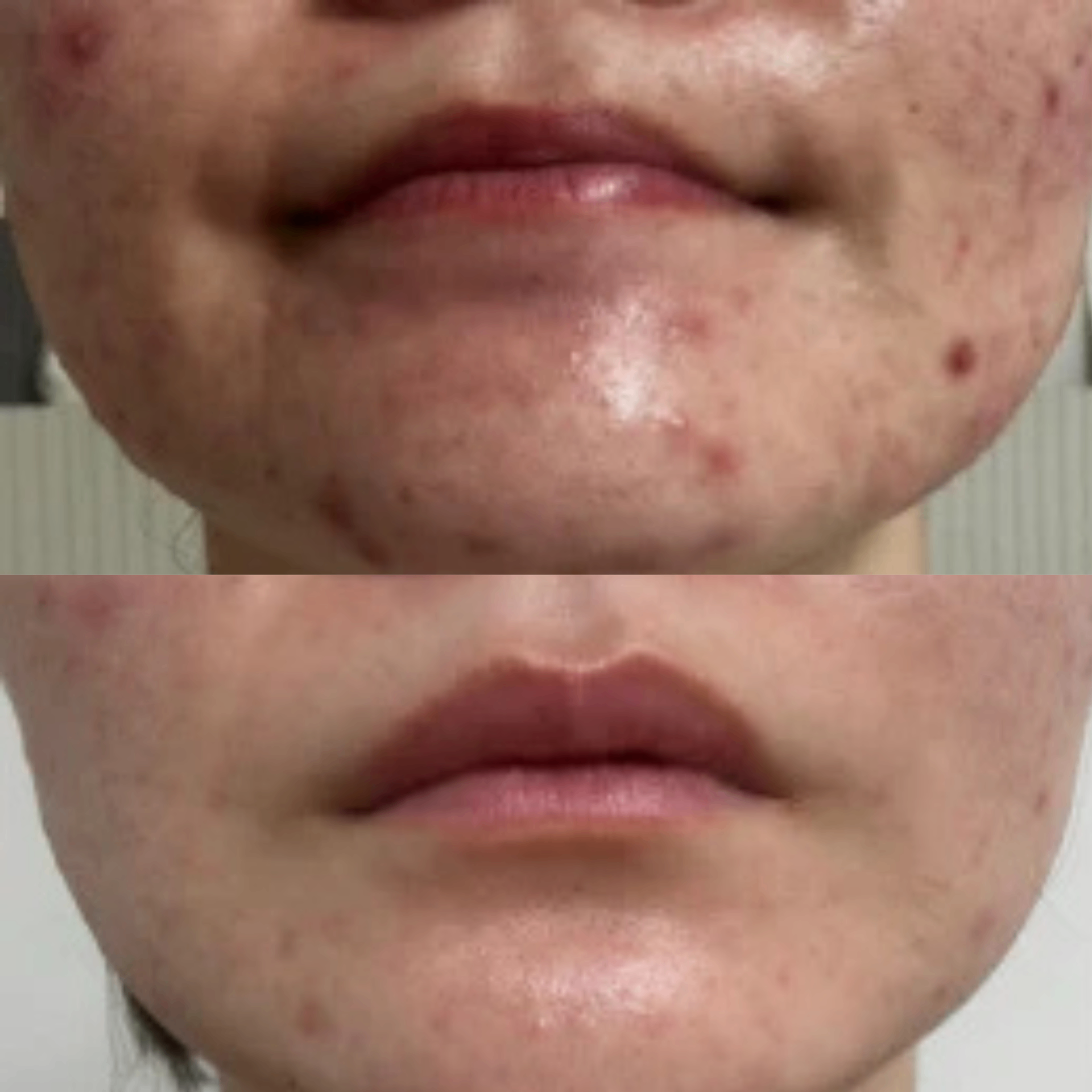 MEDIPAIR Plasma Serum photo 3