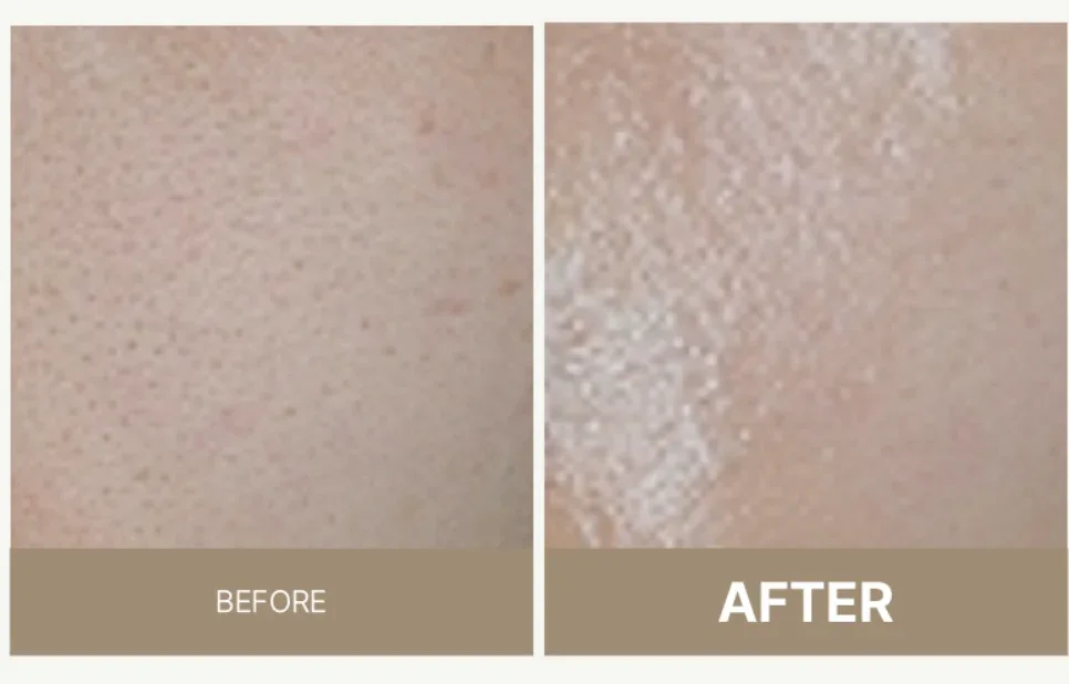 MEDIPAIR Lipo-Hydro Ampoule photo 4