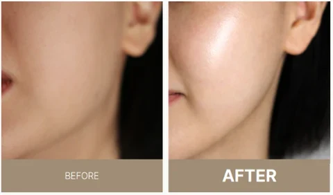 MEDIPAIR Lipo-Hydro Ampoule photo 5