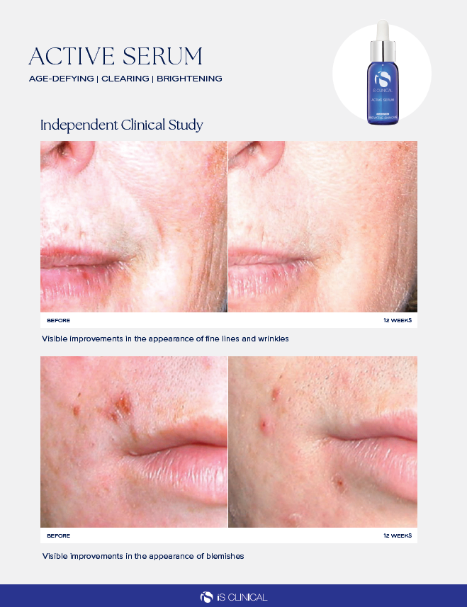 iS Clinical Active Serum photo 5