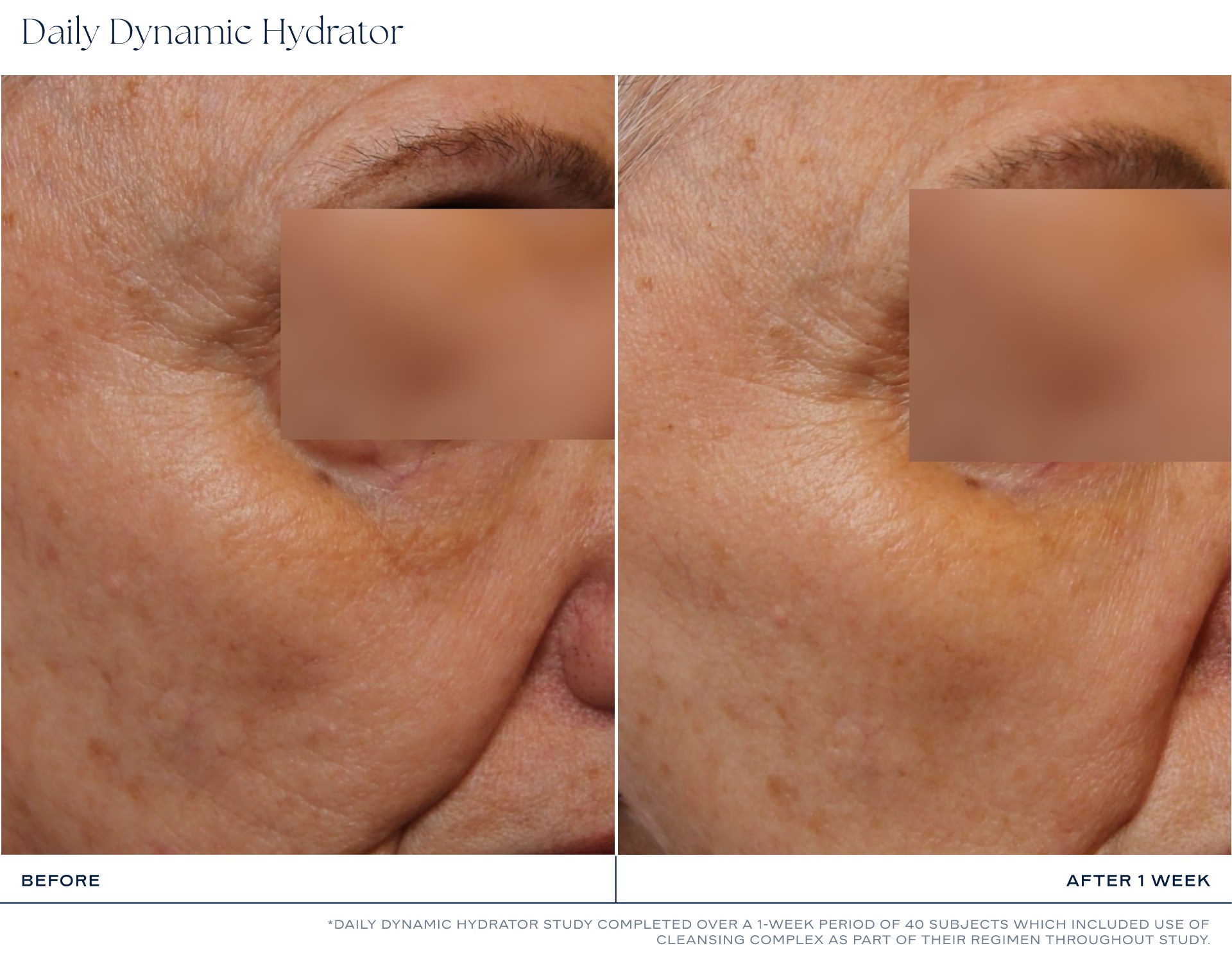 iS Clinical Daily Dynamic Hydrator photo 6