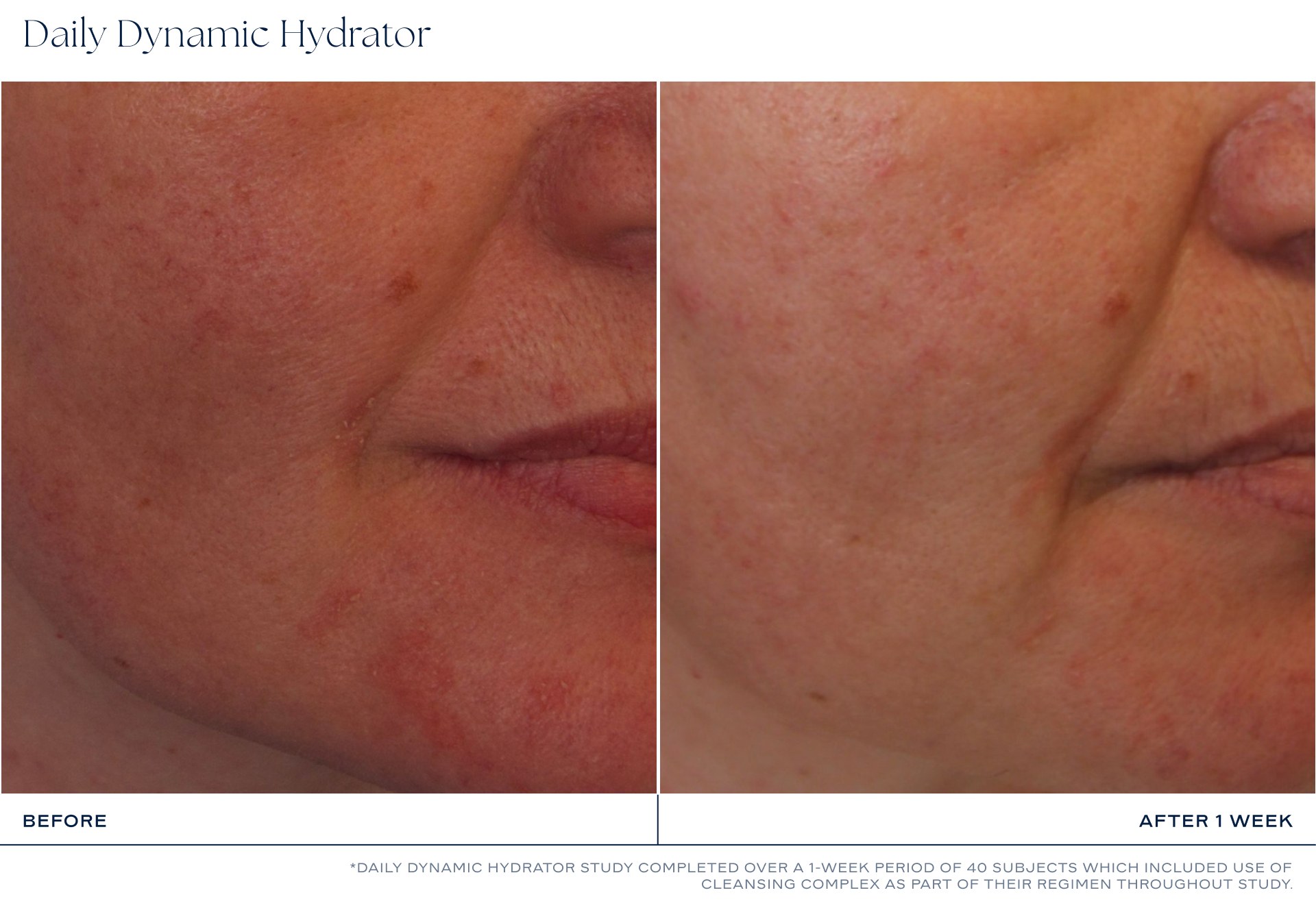 iS Clinical Daily Dynamic Hydrator photo 7